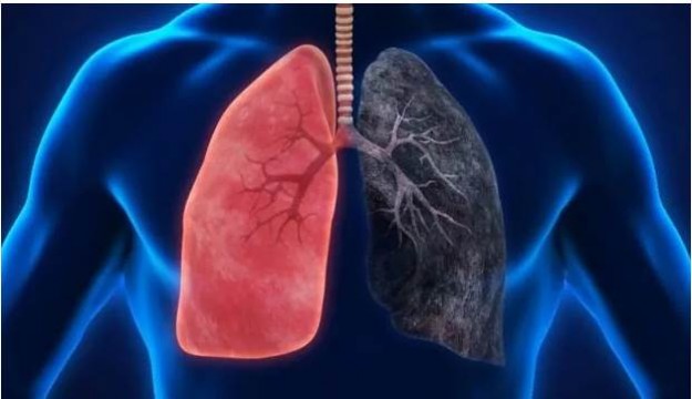 Akciğere ne iyi gelir? İşte akciğeri koruyan ve temizleyen besinler